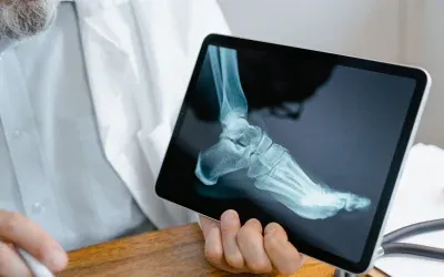 Digital X-rays