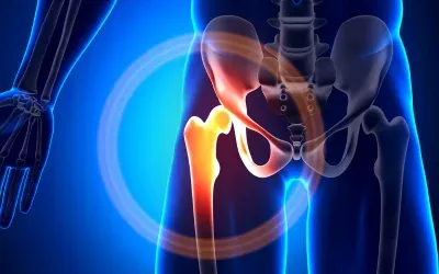 Peptic_Ulcer_Disease