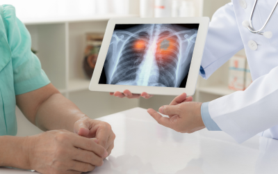 Cancer Screening Tools