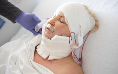 Traumatic_Brain_Injury