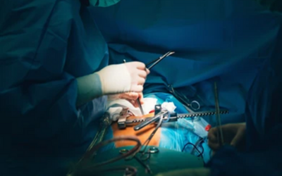 Video-Assisted Thoracoscopic Surgery VATS - Doctor Galaxy