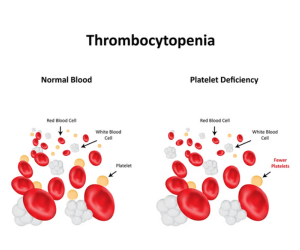 Diabetes__Blood_Sugar_Disorders
